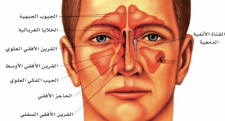 اعراض التهاب الجيوب الانفية